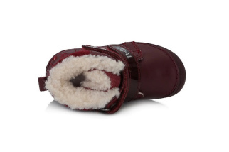 Ponte 20 - Zimné  supinované kožené topánky - Raspberry